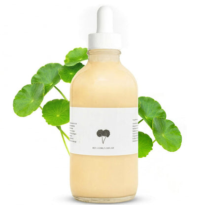 Stretch Mark Prevention Bundle Natural Skin Care Skin Care Product Pregnancy Must Haves Postpartum Recovery Kit